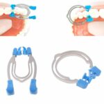 Dental-Matrix-Sectional-Contoured-Matrices-Clams-Wedges-Metal-Spring-Clip-Rings